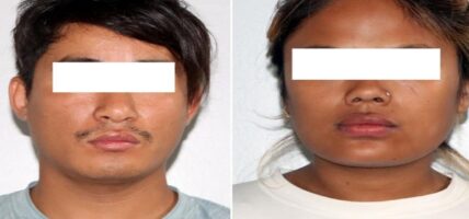 कोठामा बोलाएर यौन सम्पर्क, भिडियो बनाएर एक करोड ‘बार्गेनिङ’
