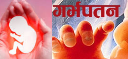 गर्भपतन गराउनेको संख्या बढ्दो,१ लाखभन्दा बढीले गराए गर्भपतन