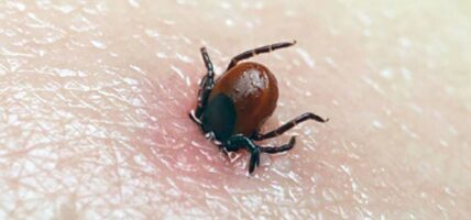 चितवनमा स्क्रब टाइफसबाट २२९ संक्रमित, एकको मृत्यु