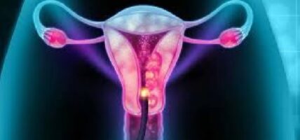 छ सय महिलाको पाठेघरको परीक्षण गरियो