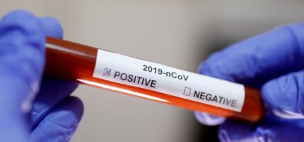 सुदूरपश्चिममा कोभिड परीक्षण गर्ने किट अभाव